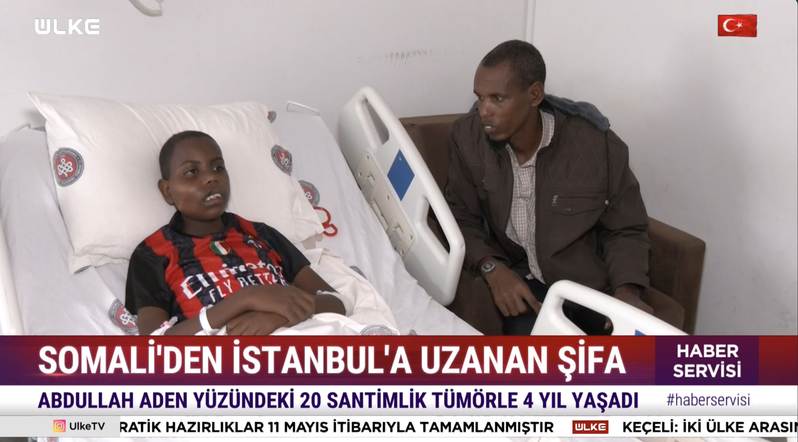 Somali’den İstanbul’a Uzanan Şifa Köprüsü: Abdullahi artık iyileşiyor!